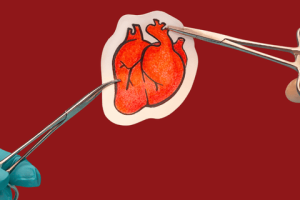 مراقبت‌های بعد از جراحی قلب باز